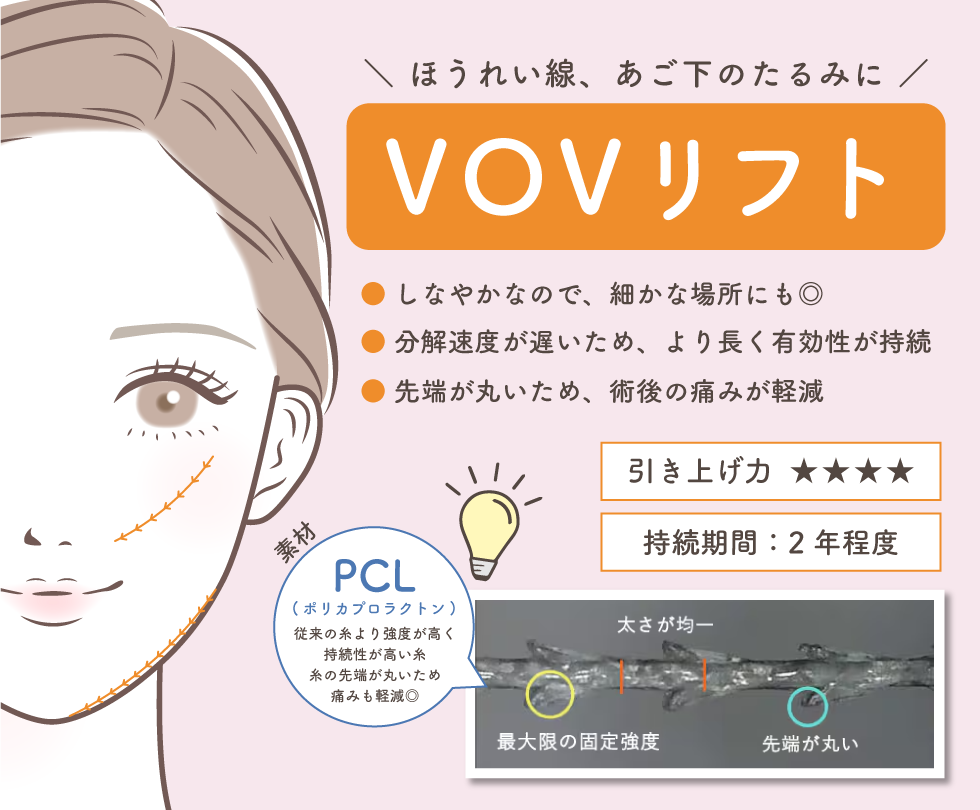 ＼大人気！VOVリフト／