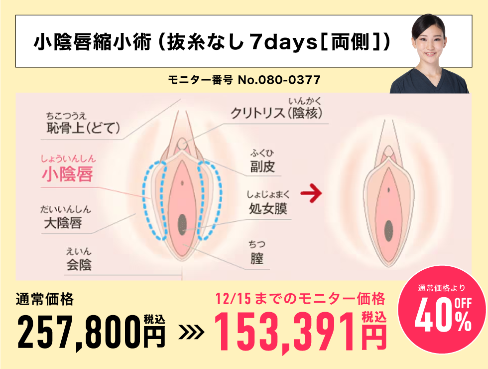 吉村先生の特別価格モニター