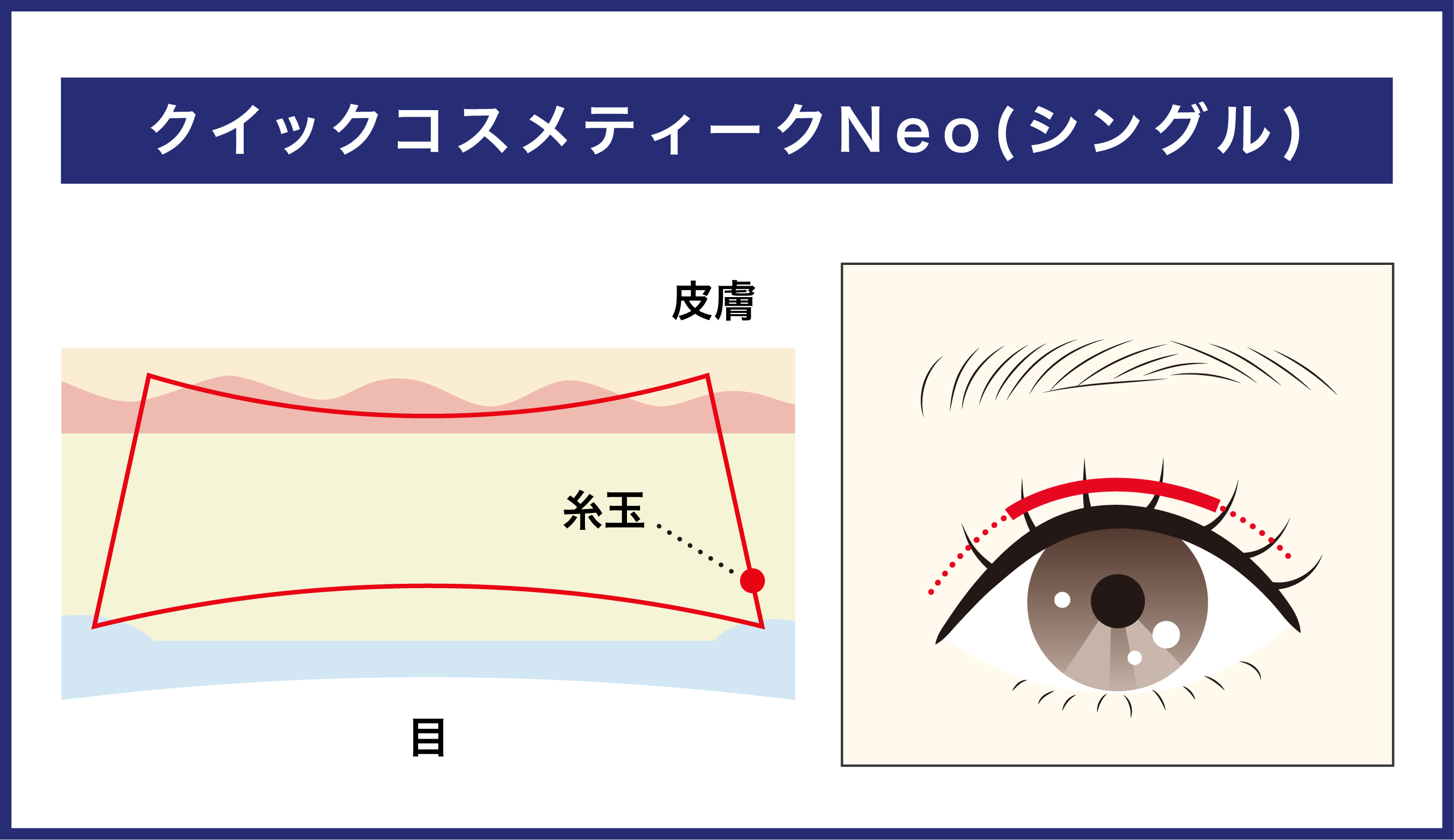 クイックコスメティーク法