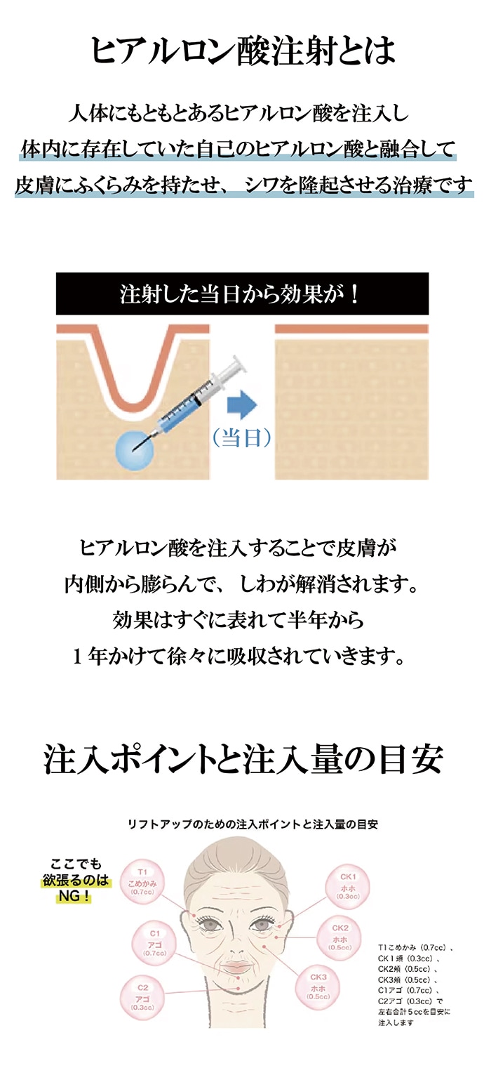 なぜ注射でほうれい線やシワを改善することができるのか