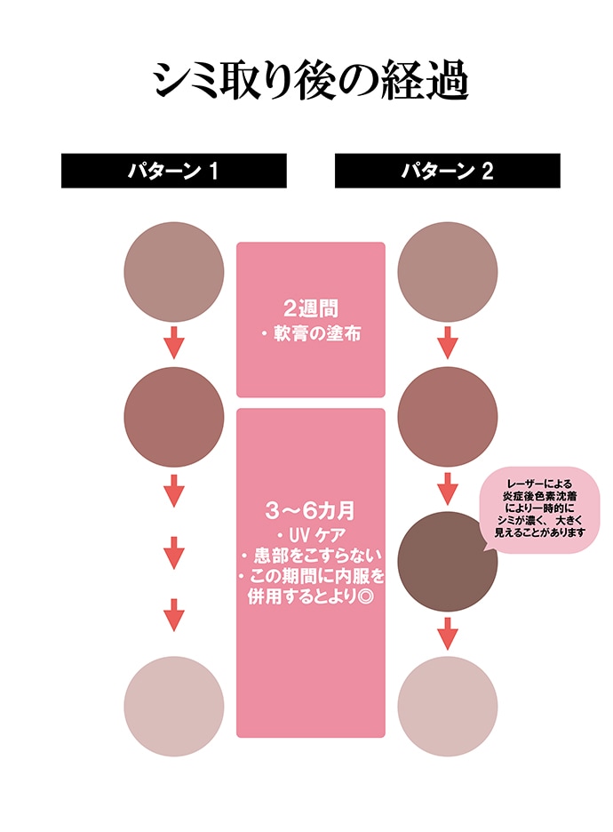 シミ取り後は2パターンに分かれる！