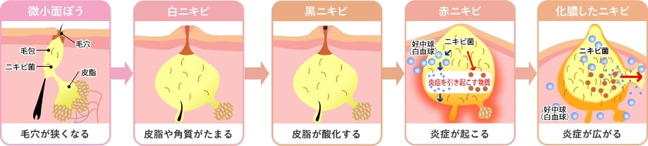 状態ごとで治療は異なります