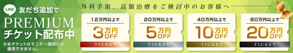 配布チケットは全部で4種類！