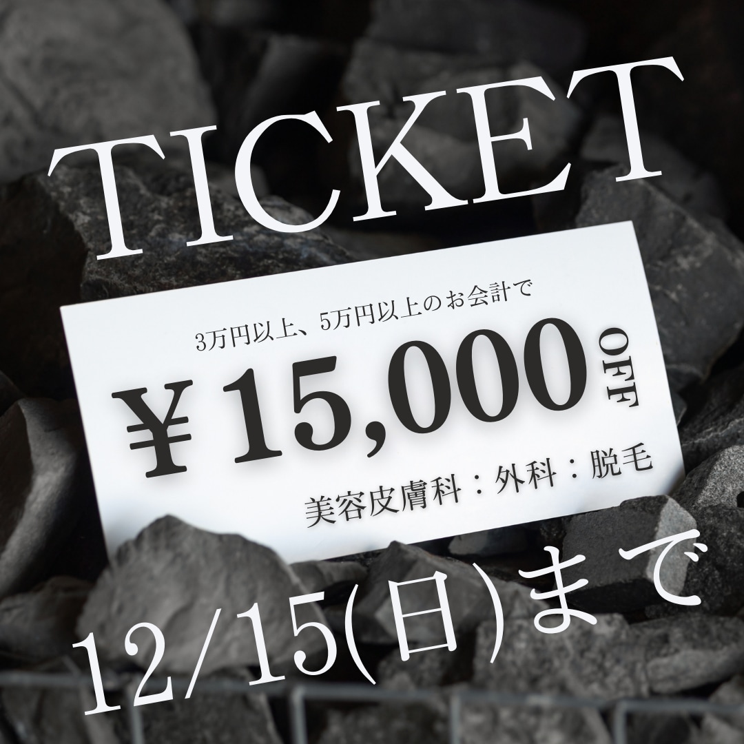 総額15,000円OFFのチケットが配布中！（12月15日まで）