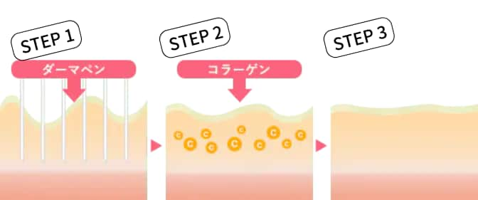 図を用いてメカニズムを解説