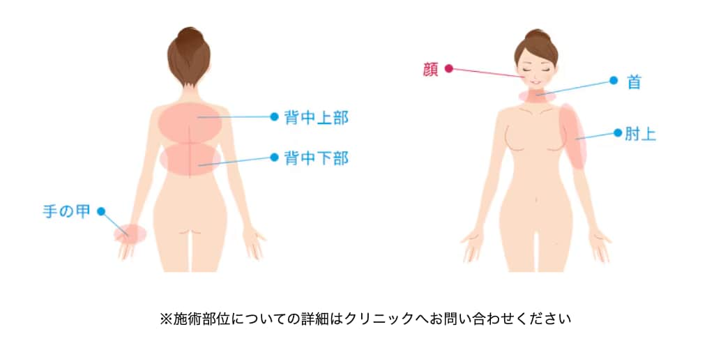 施術可能部位について