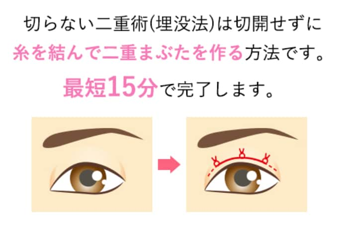 週末二重術の価格