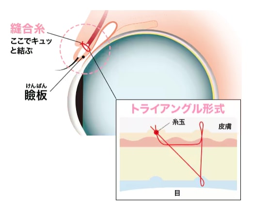 週末二重術とは・・・？