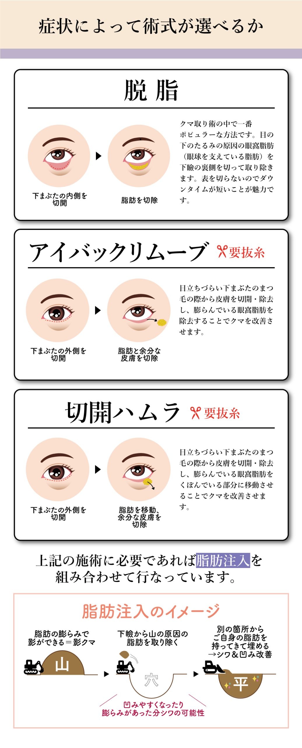 症状によって術式が選べるか