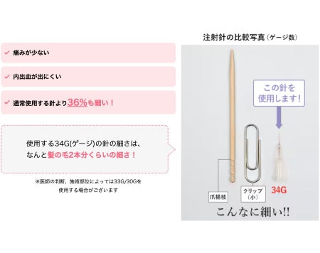 ボトックス注射のココが良い！