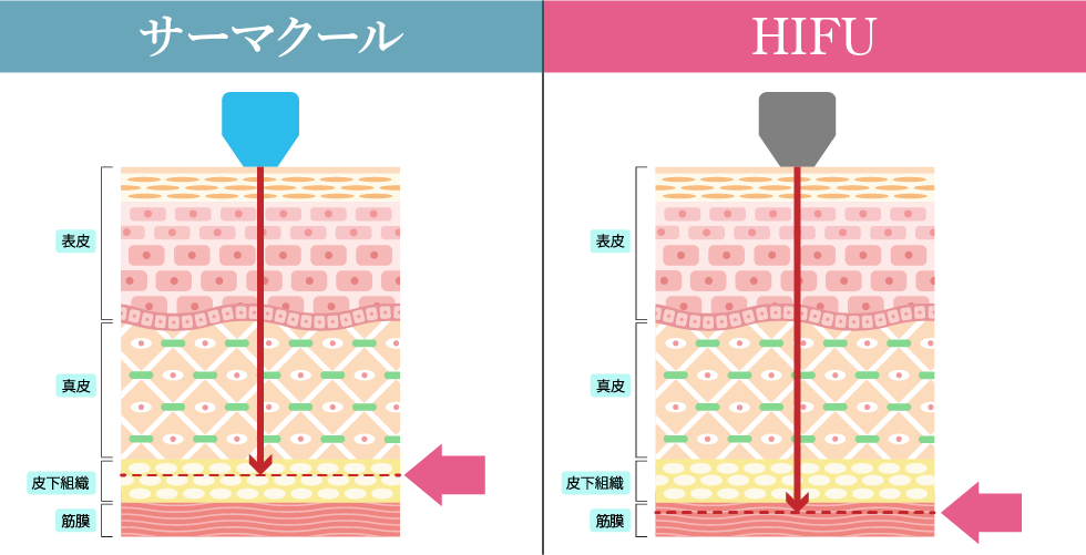 エネルギーの種類が異なる