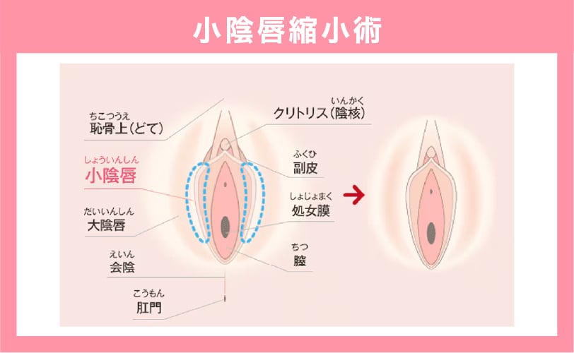 2つのお悩みを同時に解消！