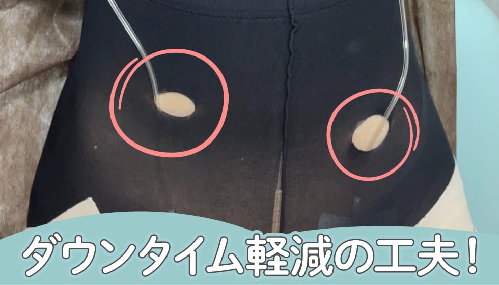 圧迫日数も減らせる！あざむくみ抑制ドレナージュとは？