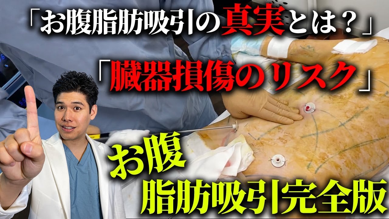 お腹の脂肪吸引は危険？脂肪吸引の危険性や失敗について徹底解説！