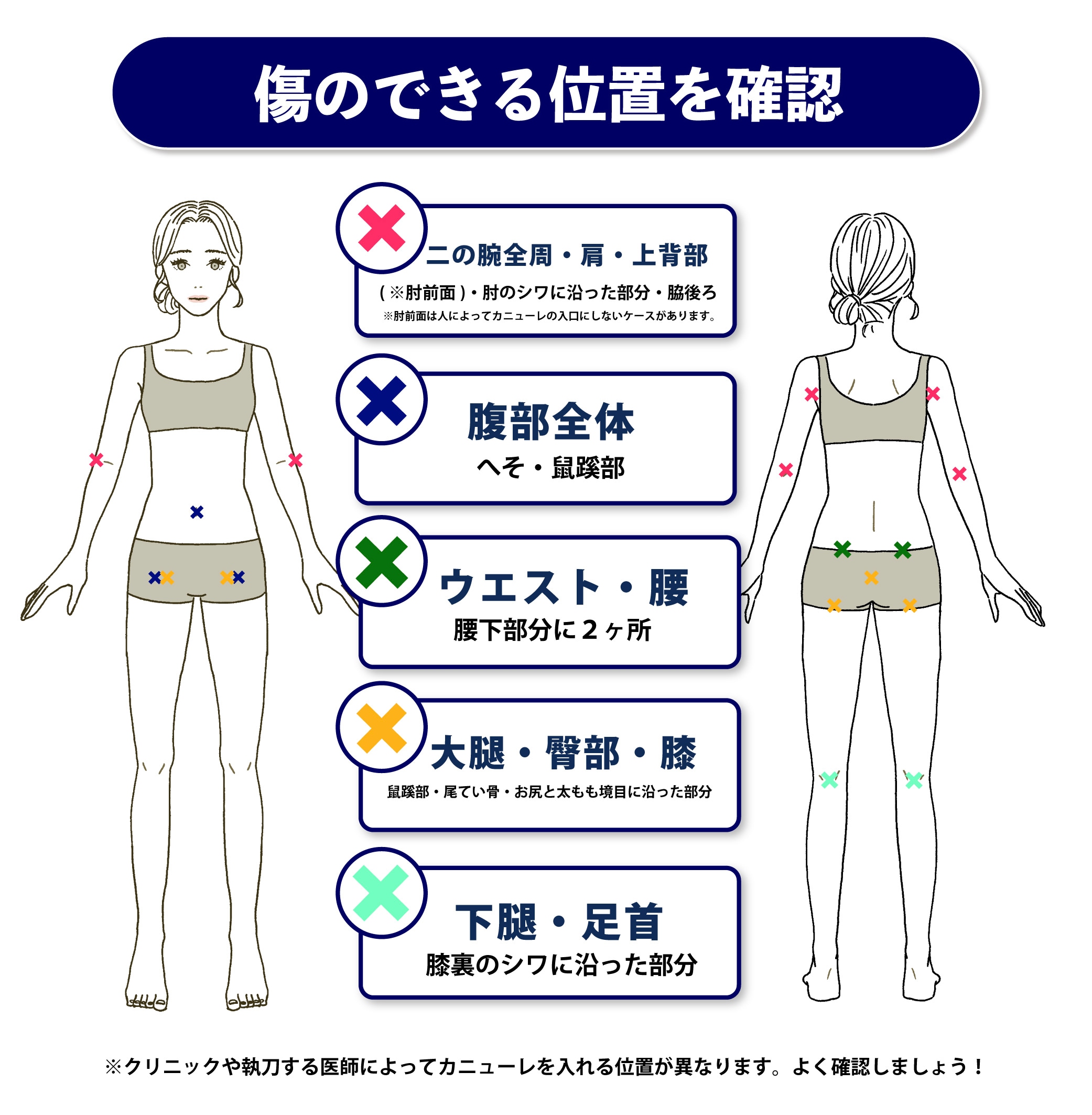 傷がどこにできるのかを確認する