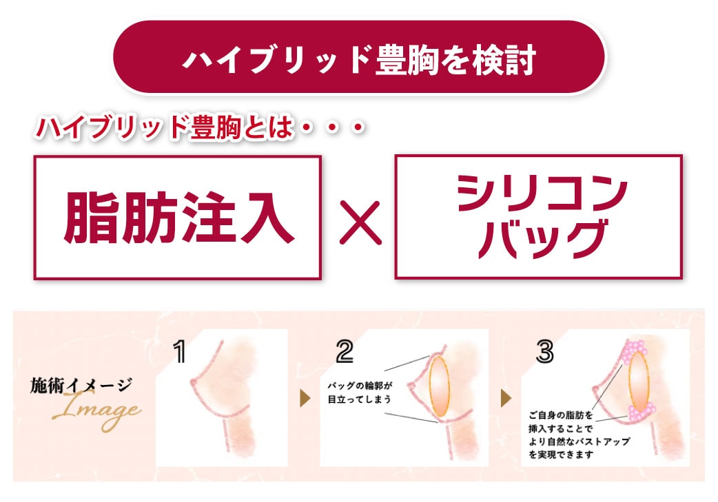 ハイブリッド豊胸も検討してみる