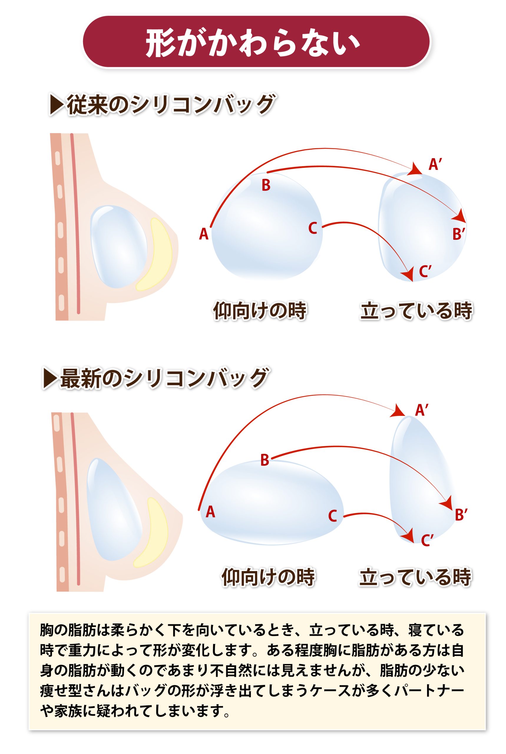 寝ているときと立っている時で形が同じ