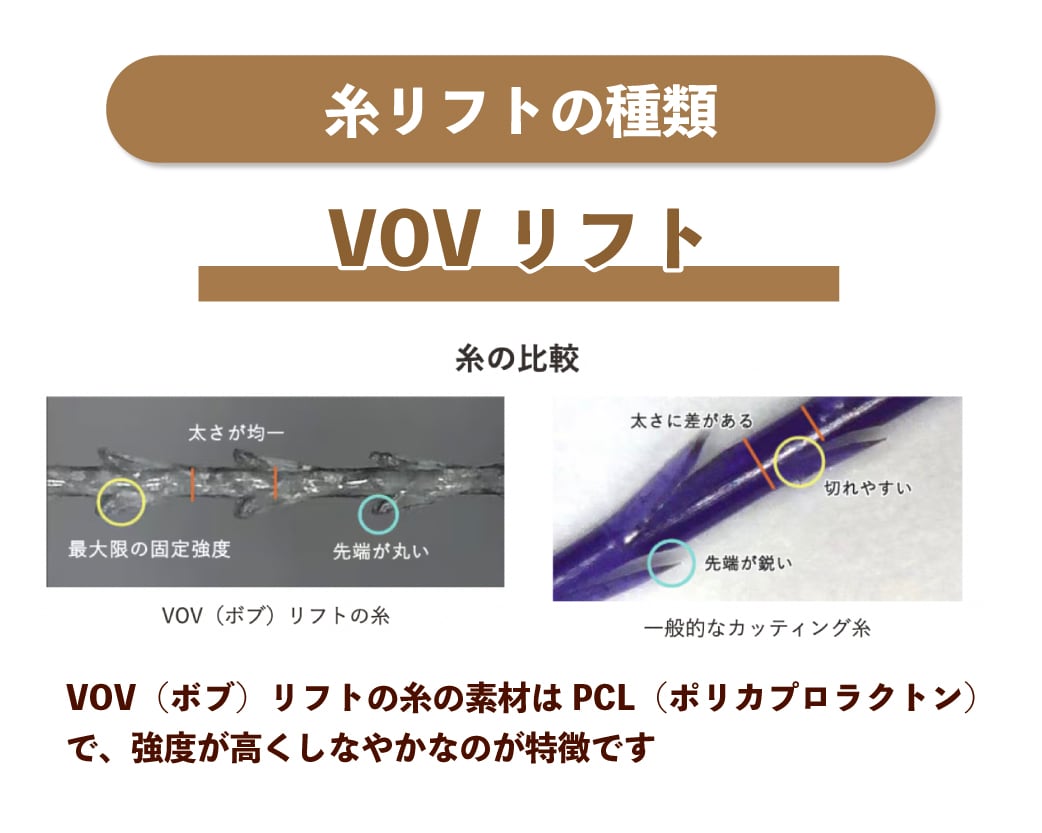 VOVリフト