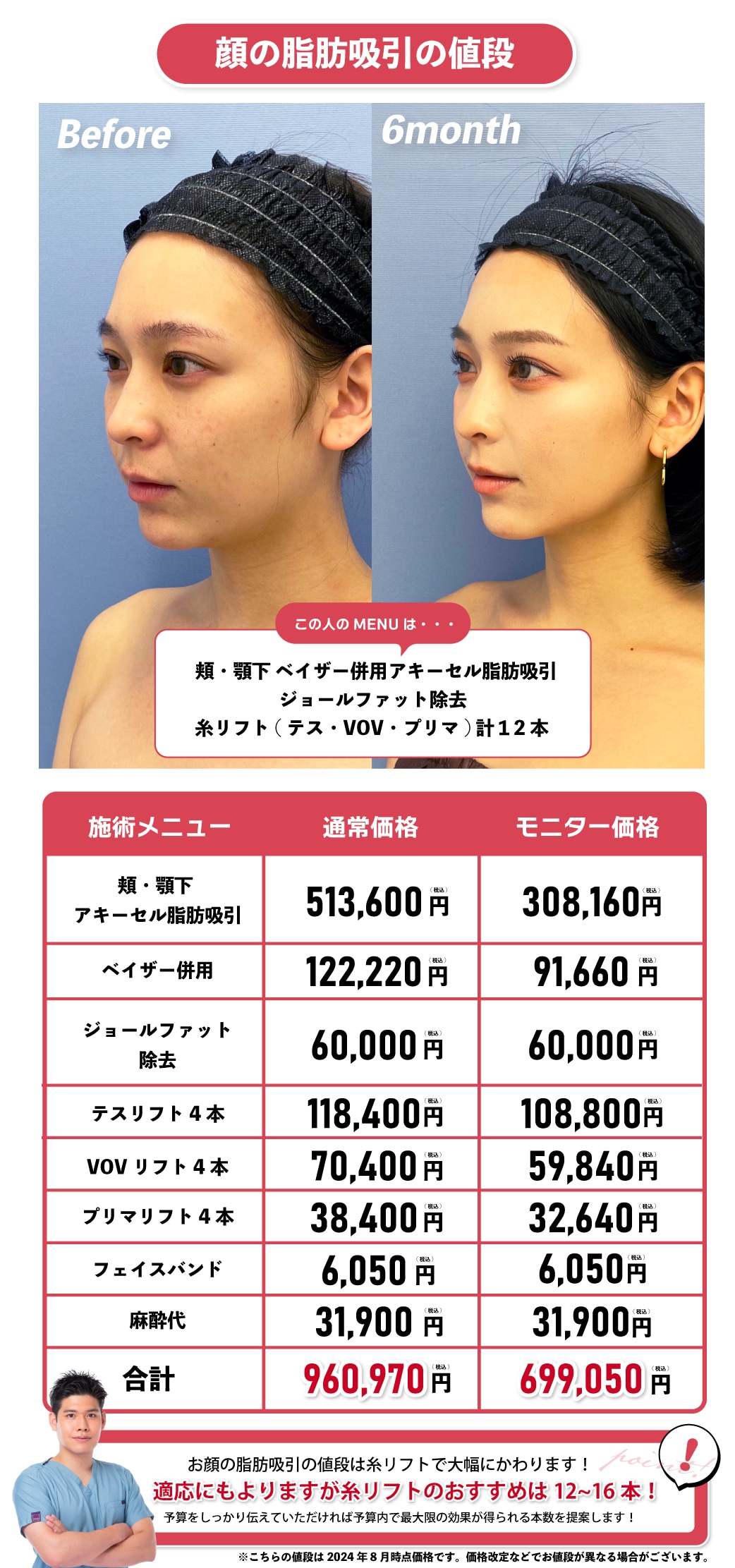 葛島先生の顔の症例で見る脂肪吸引の値段