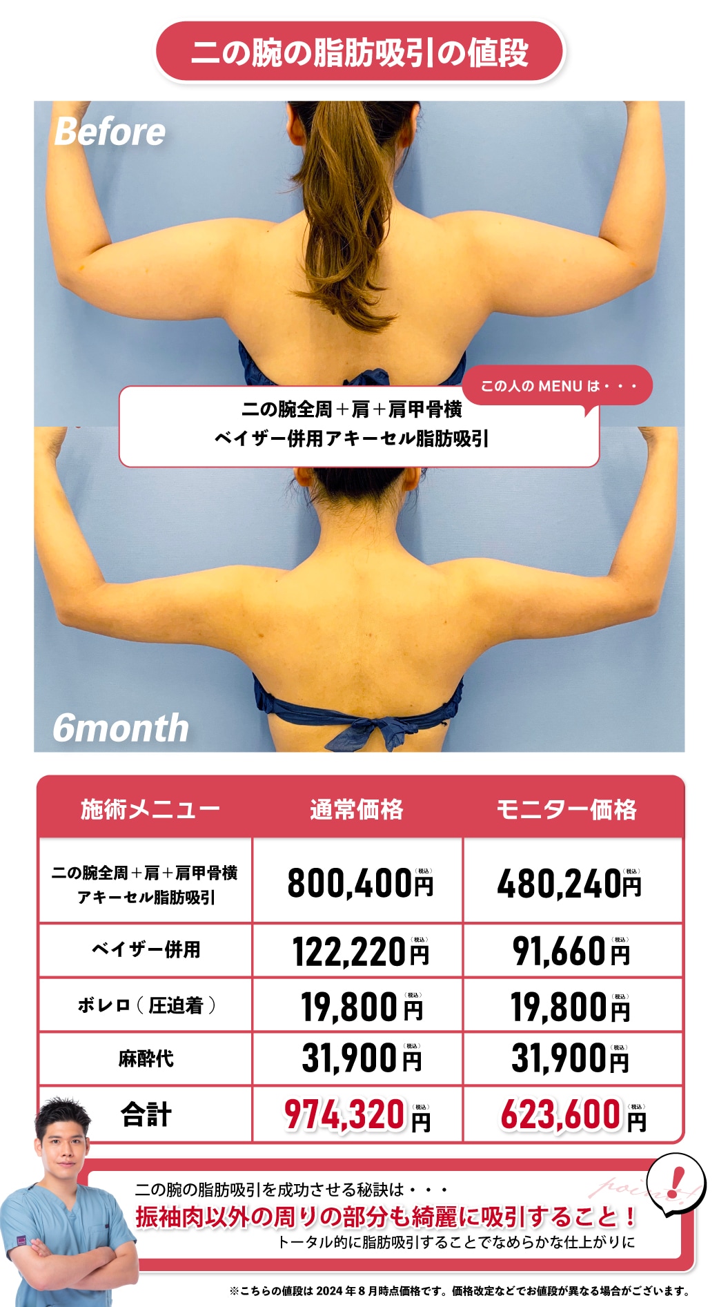 葛島先生の二の腕の症例で見る脂肪吸引の値段