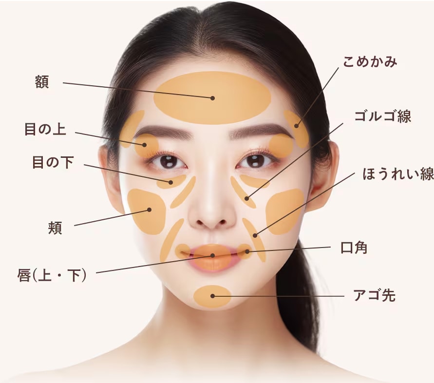 顔の脂肪注入　対象部位