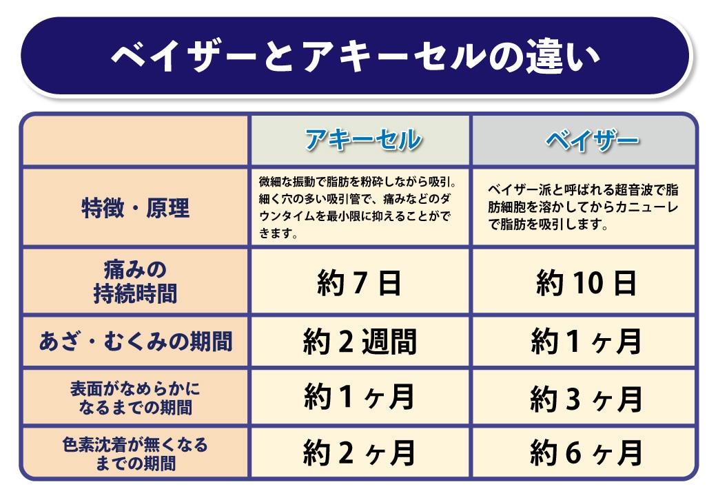 脂肪吸引の機械の種類は沢山ある！