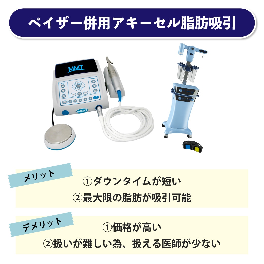 ベイザー併用アキーセル脂肪吸引のメリット