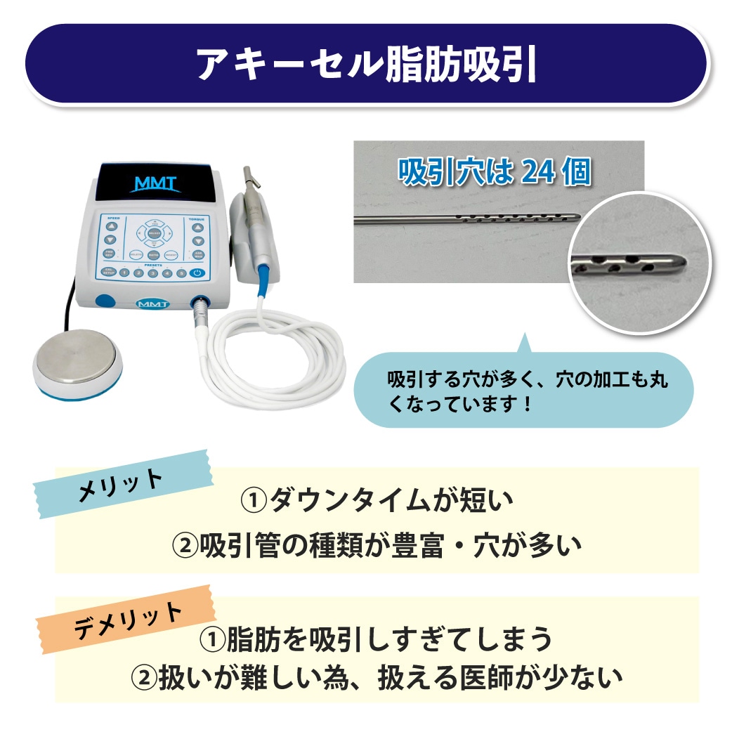 アキーセル脂肪吸引のメリット