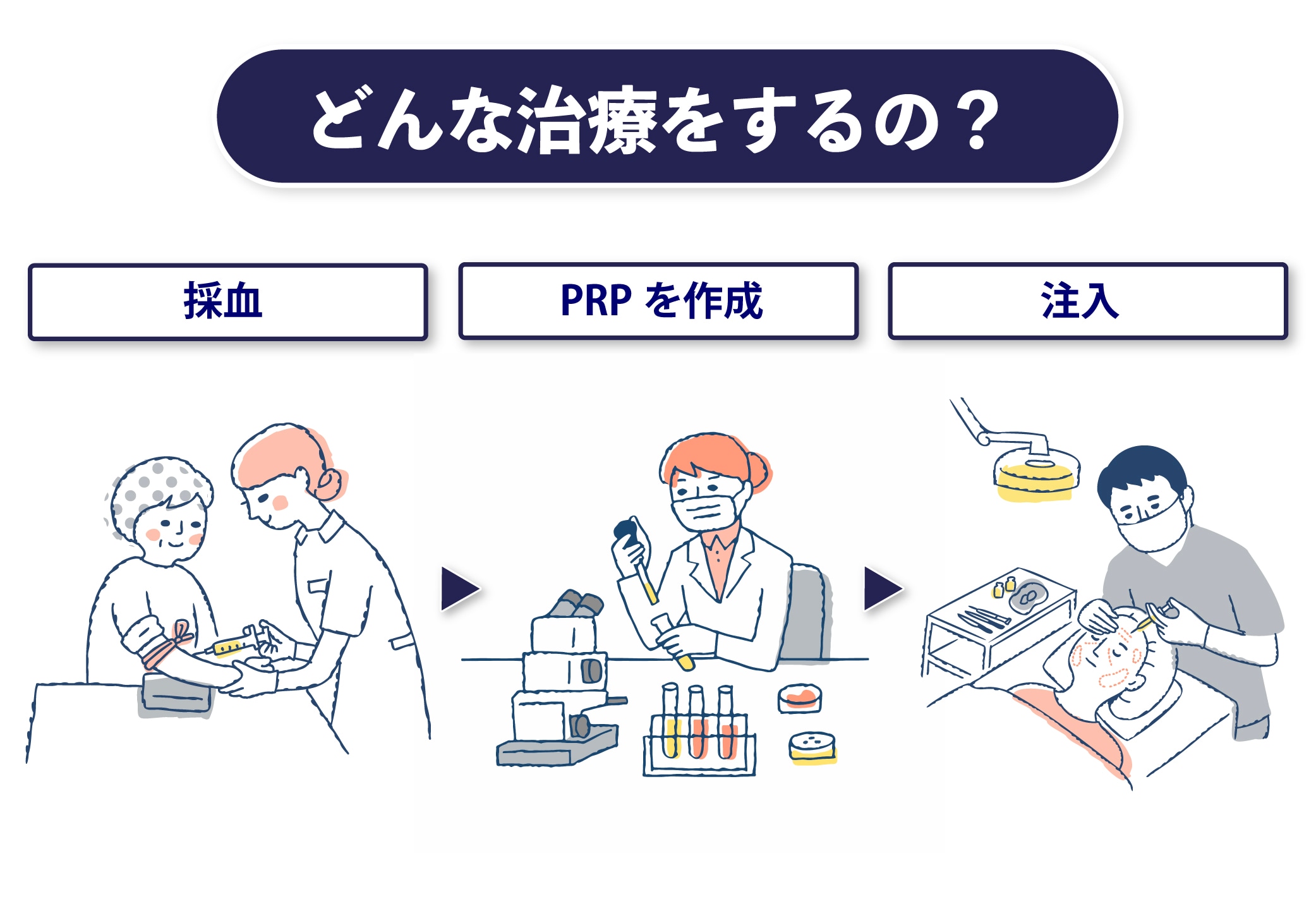 PRP皮膚再生治療は何をするの？