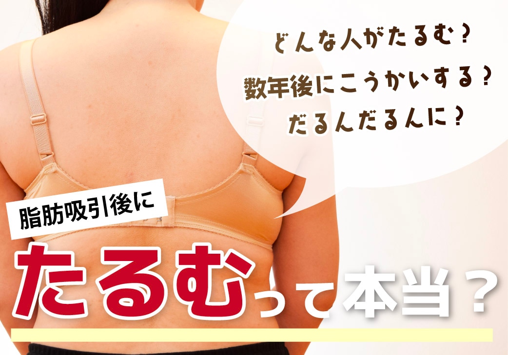 脂肪吸引をすると将来たるむ！？皮膚がたるんでしまう原因とその回避方法！