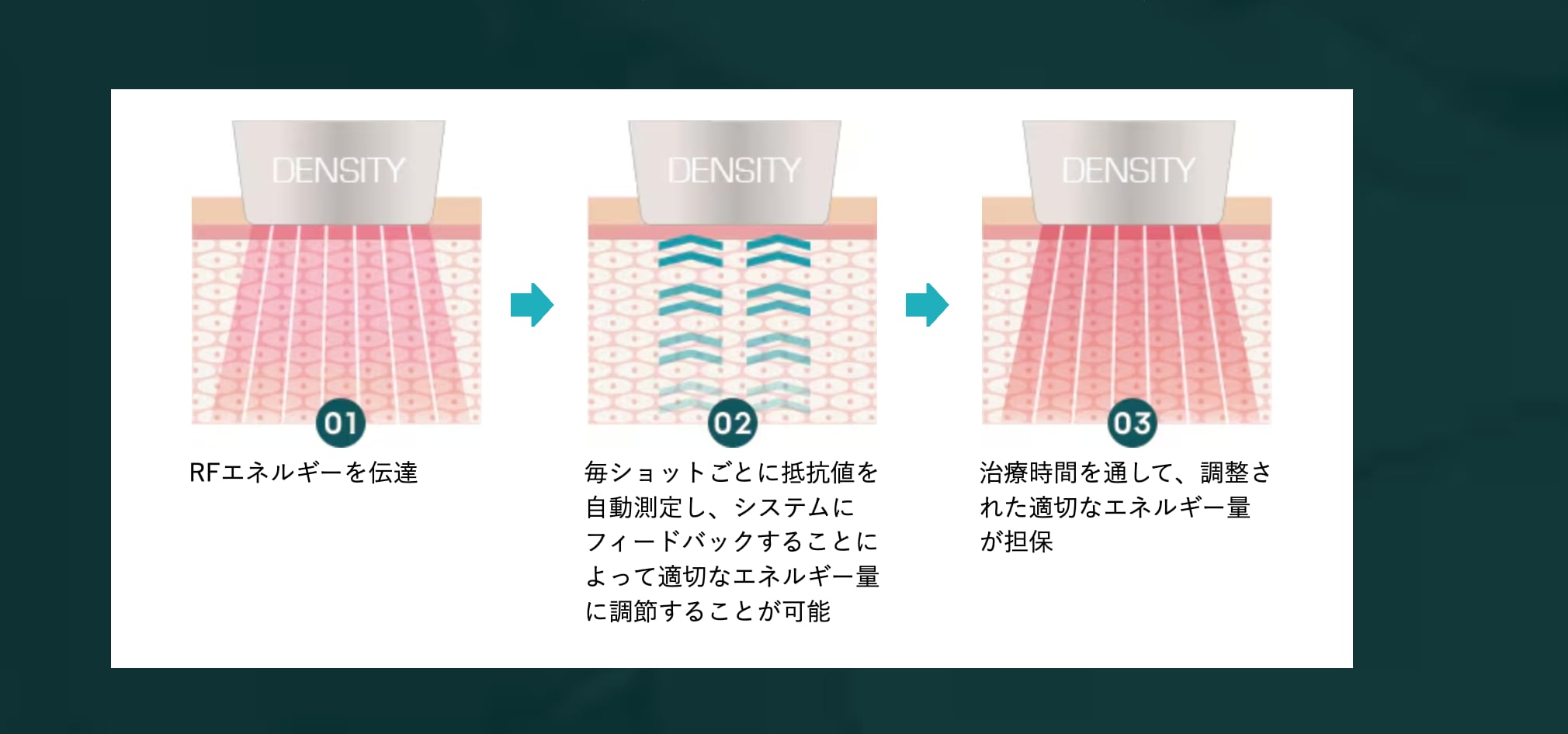 リアルタイムインピーダンスチェック機能