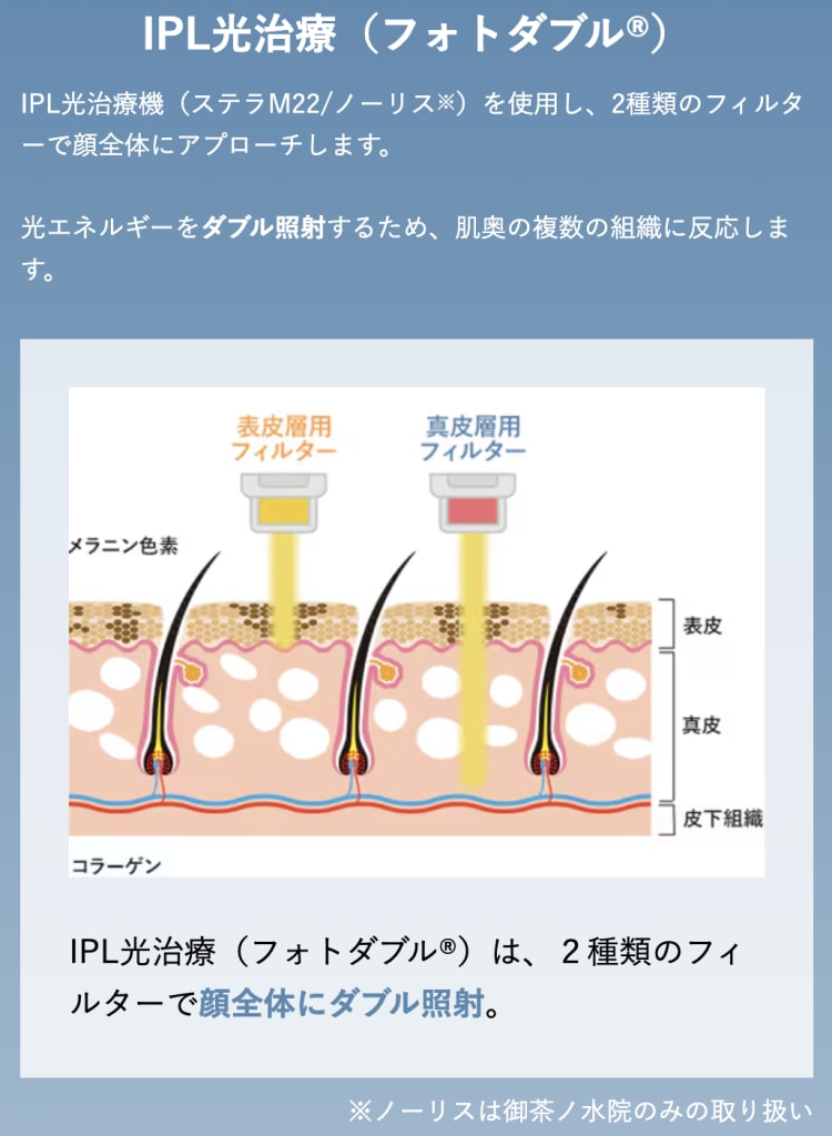 トライアルキャンペーン