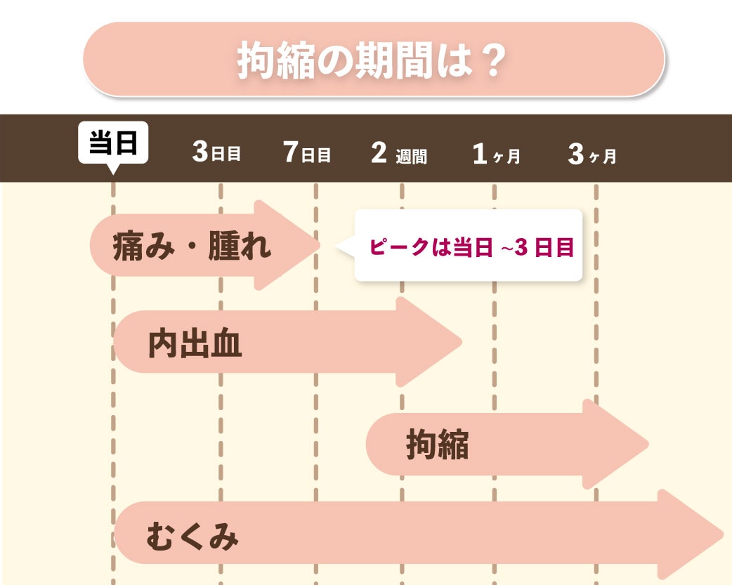 拘縮はいつから始まる？いつまで続く？