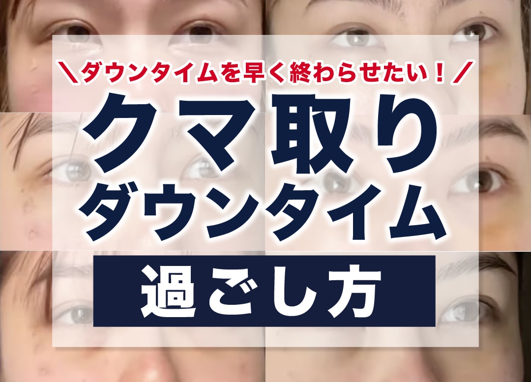 クマ取り後のダウンタイムの過ごし方って？ダウンタイムを短くするためにして欲しいこと・避けてほしいこととは？