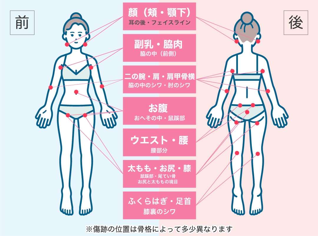 目立ちにくい位置に作っている