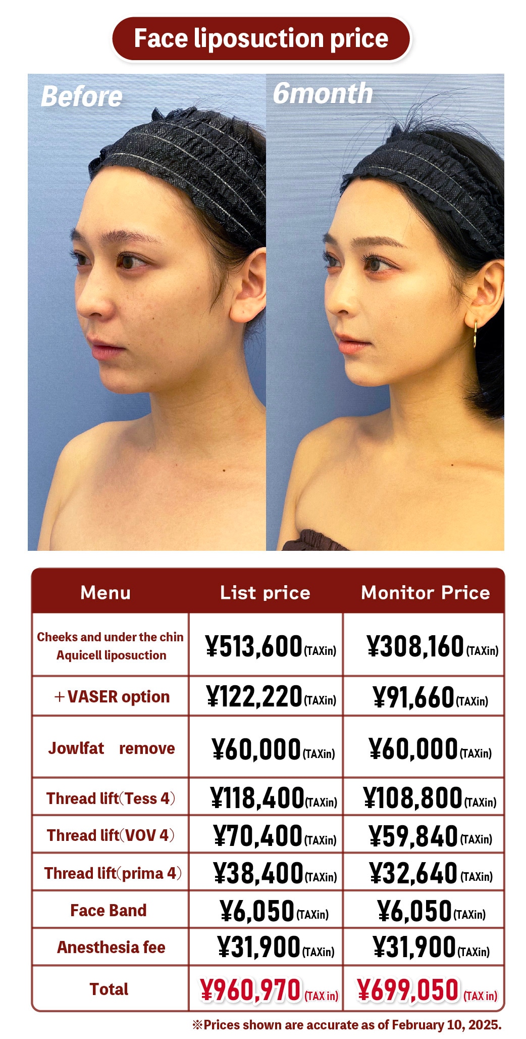 face liposuction price