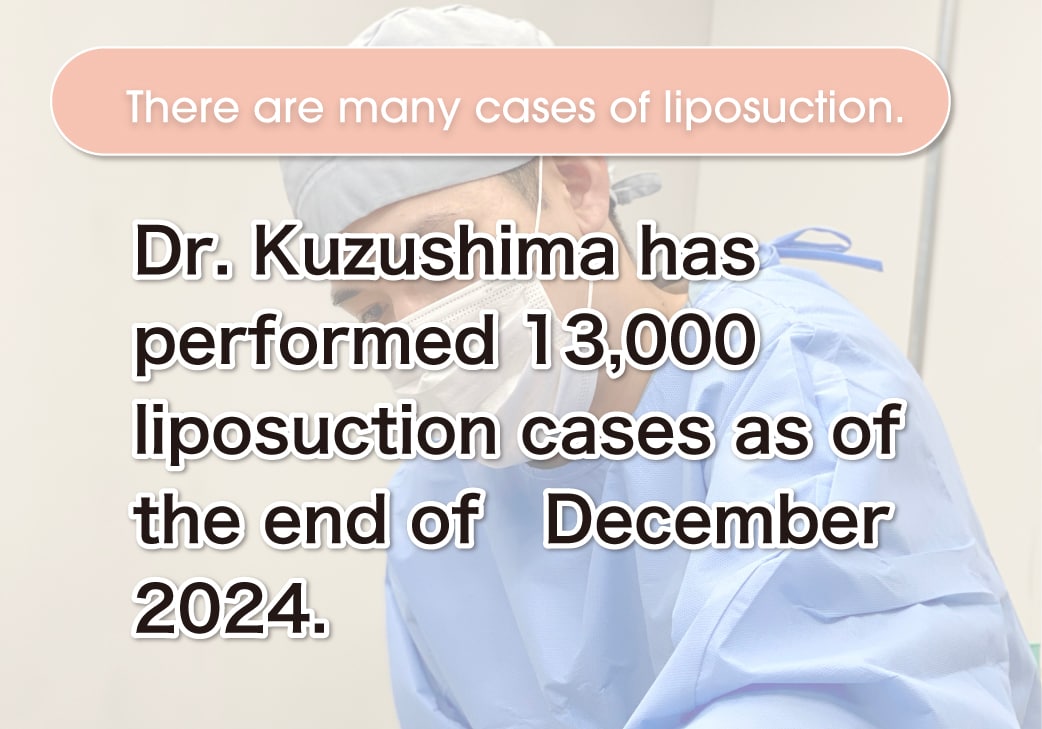 Over 13,000 liposuction cases