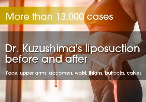 Before and after liposuction case photos by famous liposuction doctor Kuzushima Shonan Beauty Clinic Ginza in Tokyo