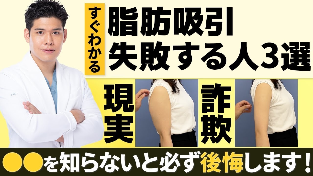 脂肪吸引で失敗しやすい人の特徴3選！後悔を避けるためのポイントとは？