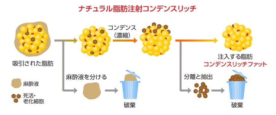 コンデンスリッチ