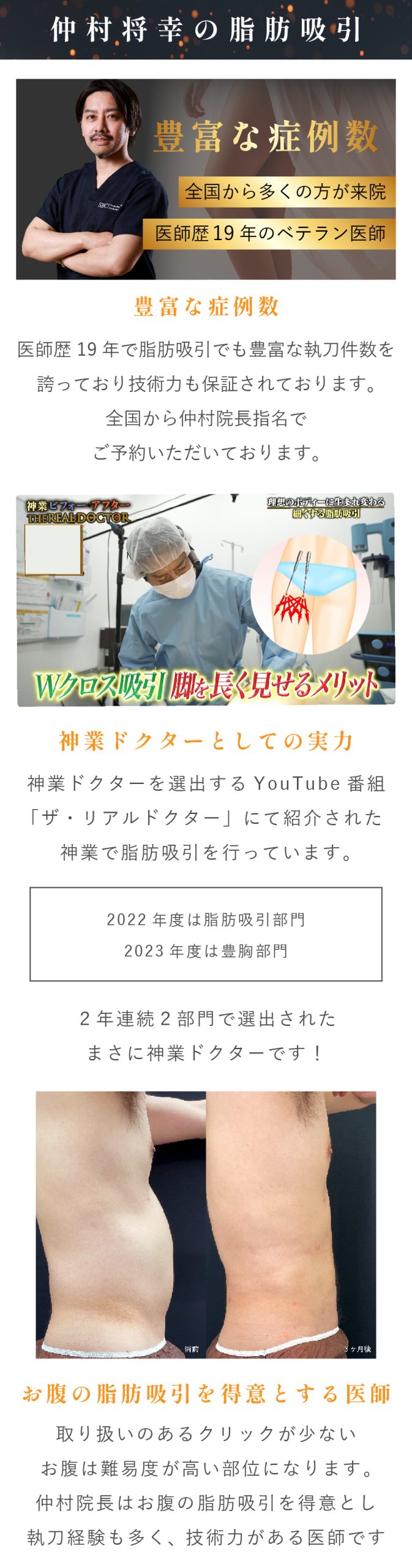 脂肪吸引するなら仲村院長なワケ