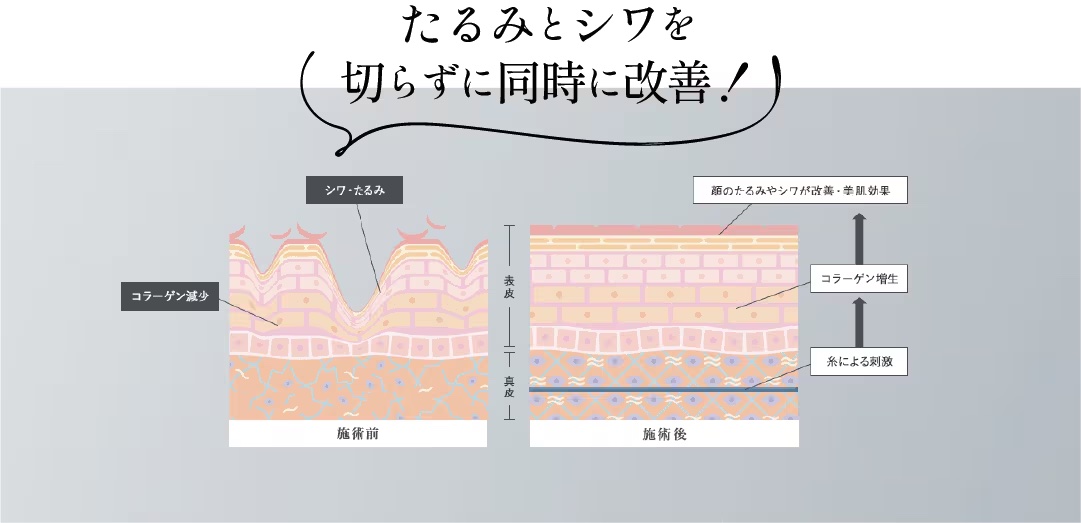 だからこんなに効果がある！！