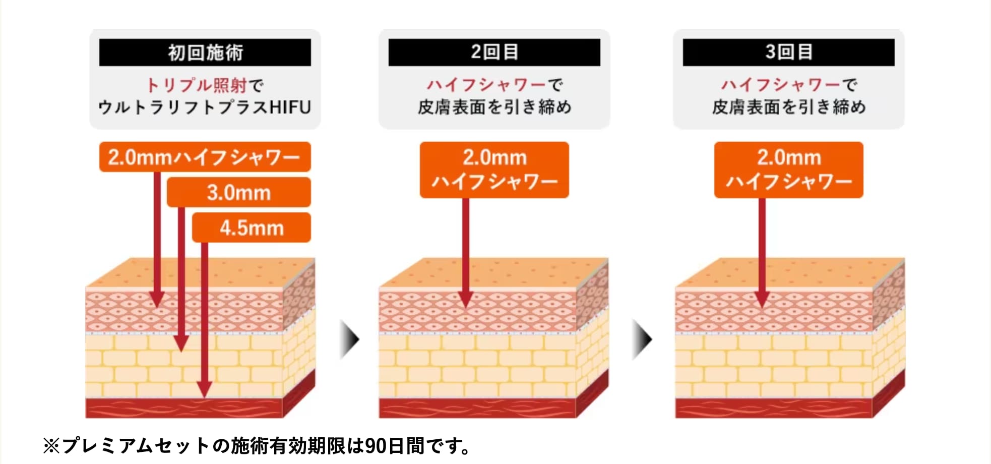 HIFUが1回とHIFUシャワーが2回行えるお得なセットメニューです💓