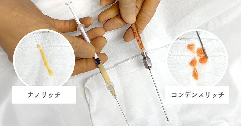 脂肪注入には2種類ある