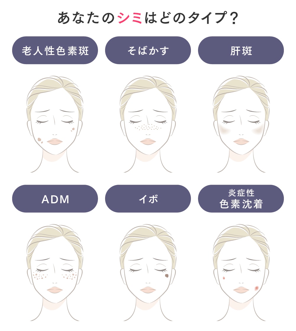 正確な診断には医師の診察が必要です◎