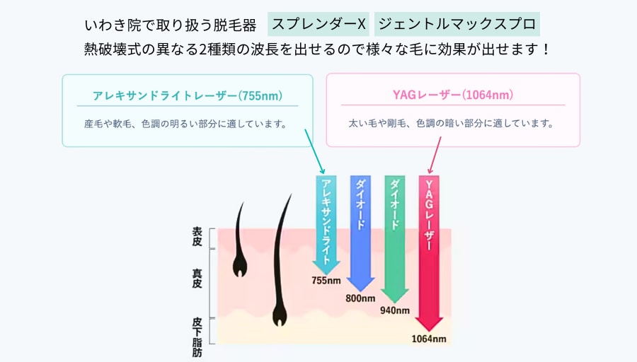 高性能の機械で最短1年で脱毛完了