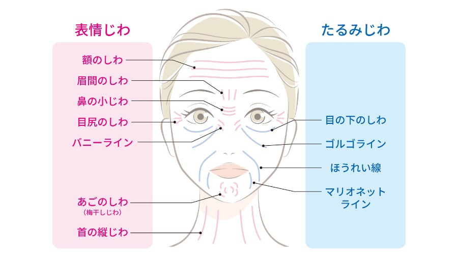 ２種類のしわ