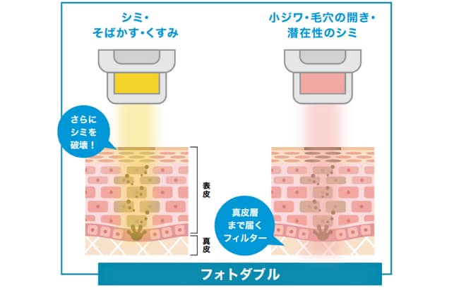 フォトダブル®