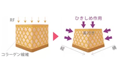 肌のタルミが気になってきた方