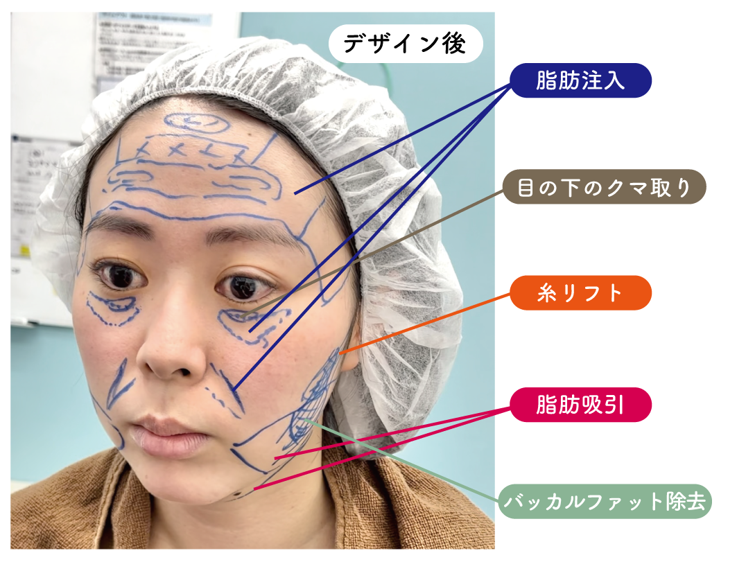 ＼まるで民族？気になるところを組まなくチェック／